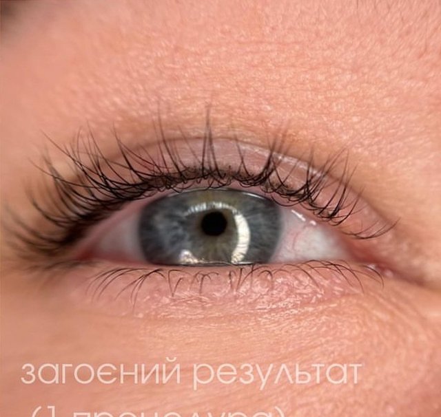 Загоєний результат — міжвійка